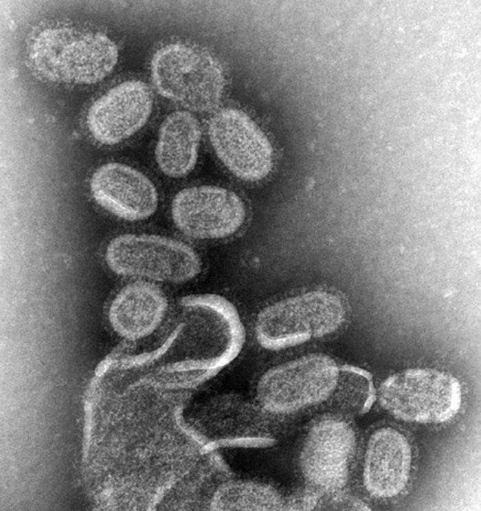 電子顕微鏡で撮影されたインフルエンザウイルス